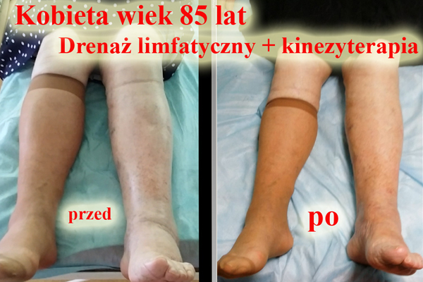 zdrowsza starość