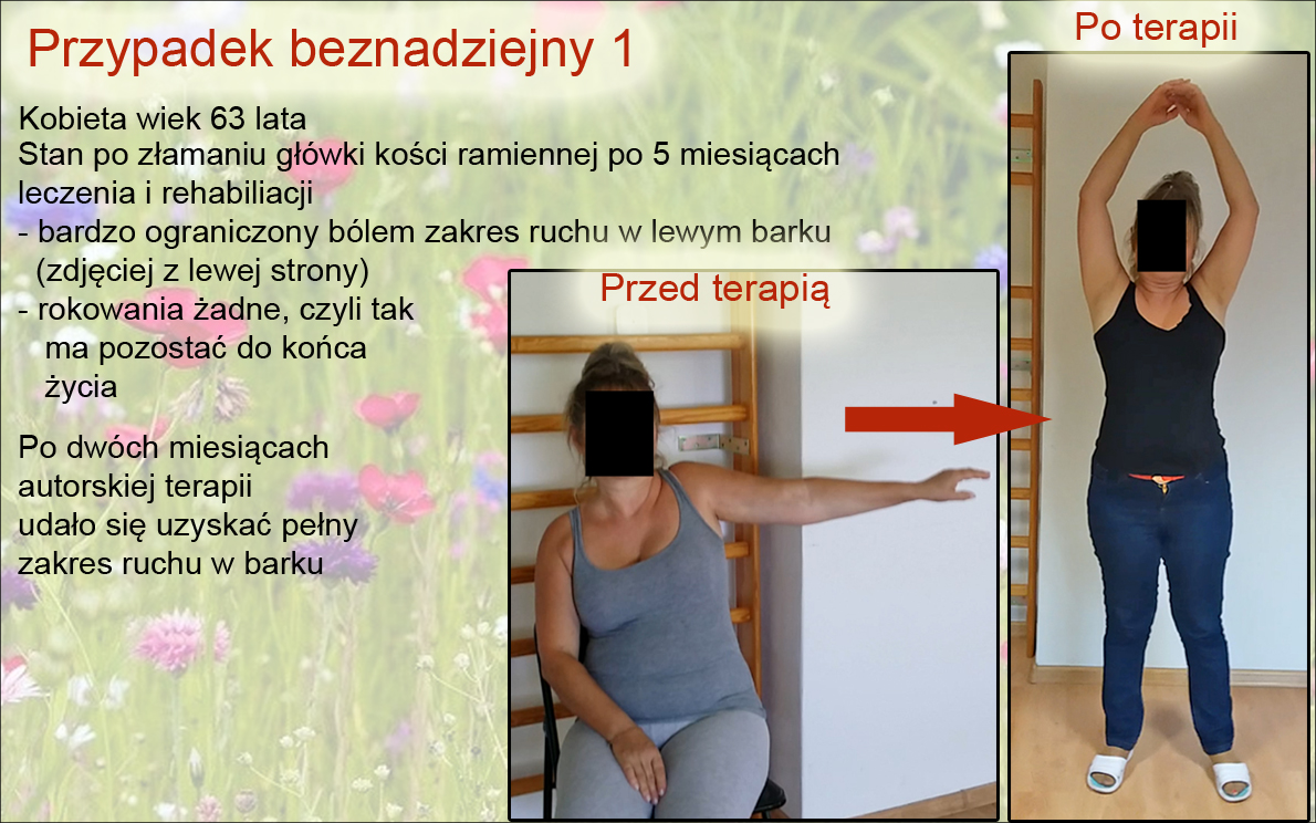 przypadek beznadziejny 1